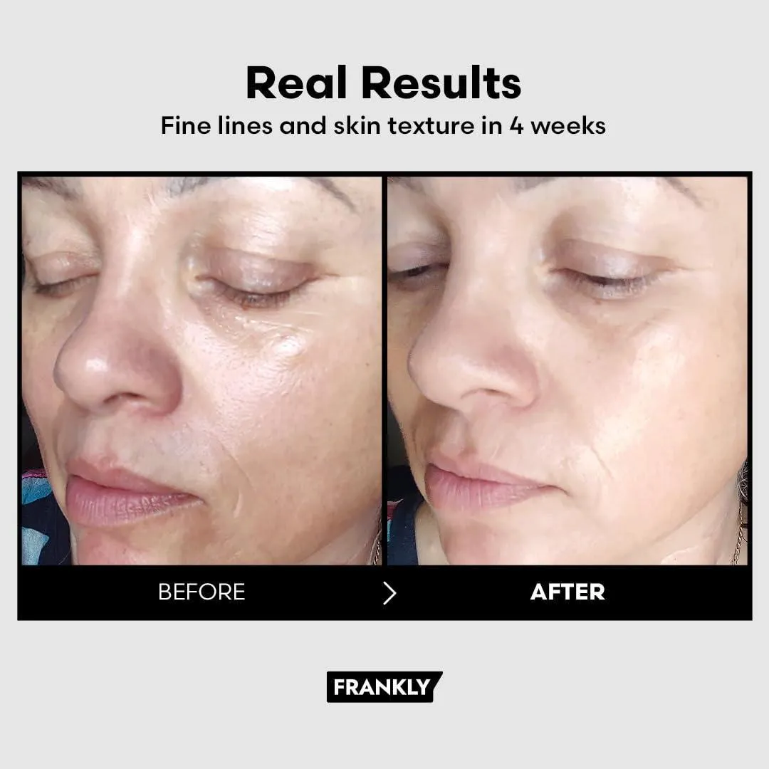 [FRANKLY] Retinol 0.1 Cream 30ml